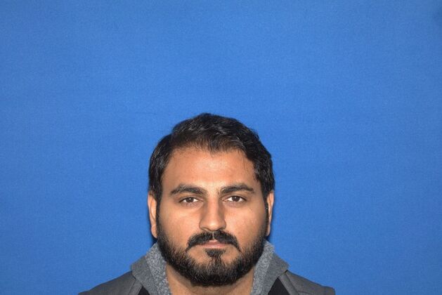 fully restored hairline and crown hair